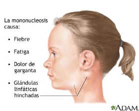 Mononucleosis infecciosa: MedlinePlus enciclopedia médica ...