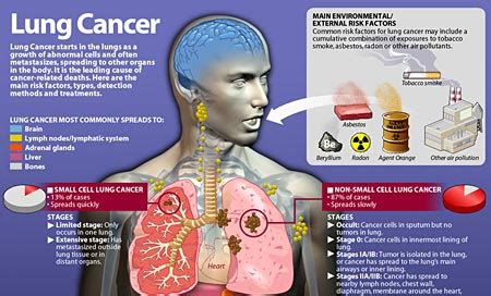 Most Common Types Of Cancers In The World 2016 | Bewitter.com