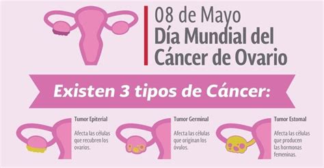 Mujer con cáncer de ovario   ↓ Causas, Síntomas ...