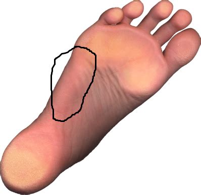 My foot sole muscle  hurts when running | Foot Health Forum
