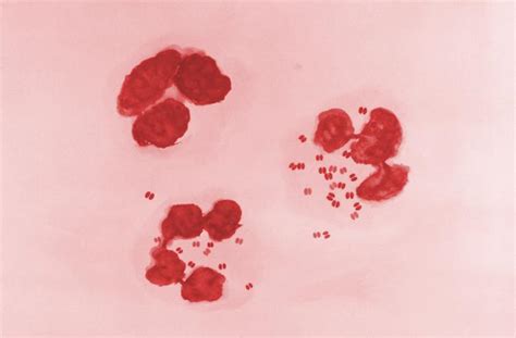 Neisseria gonorrhoeae | Mechanisms of Pathogenicity