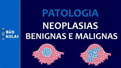 Neoplasias Benignas e Malignas   Características, Nomenclatura e ...