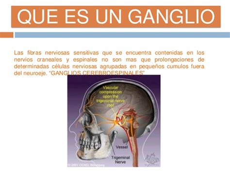 Neuroanatomiatrigemino 130508183609 phpapp01
