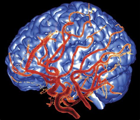 New Alzheimer s therapy with brain blood flow discovery ...