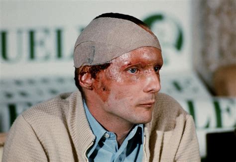Niki Lauda : le jour où il a frôlé la mort après un grave ...