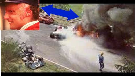 Niki Laudas Unfall auf dem Nürburgring: Wie er die Flammen ...