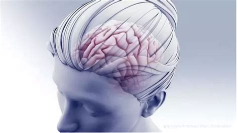 Nueva terapia dirigida a las metástasis cerebrales del ...