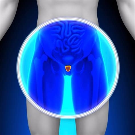 Nueva vía para tratar la hiperplasia benigna de próstata