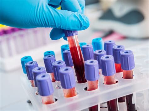 Nuevo análisis de sangre podría detectar más de 20 tipos ...