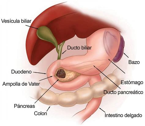 Olaparib para cáncer pancreático con mutaciones en BRCA ...