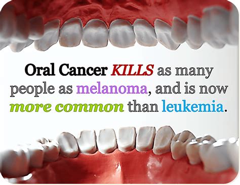Oral Cancer  The Types, Causes & Treatment   Dentist Says
