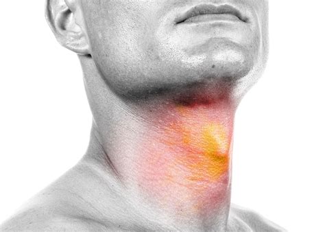Oral, Head and Neck Cancer Awareness Week | American ...