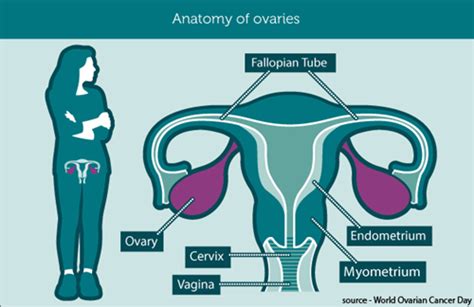 Ovarian Cancer Canada   About ovarian cancer