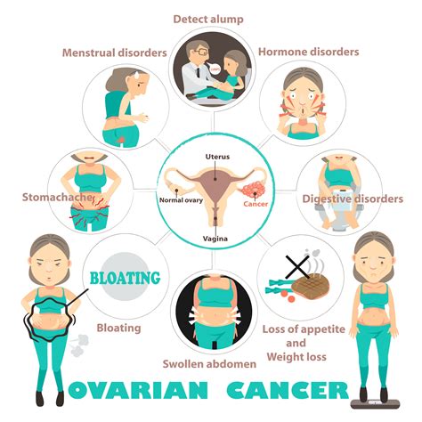 ovarian cancer infographic | oncology information figure ...
