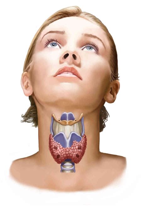 Overdiagnosis Could Be Behind Jump In Thyroid Cancer Cases ...