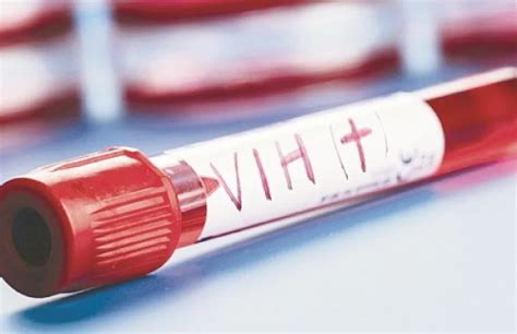 Pacientes con VIH Sida son doblemente vulnerables ante Covid 19 ...