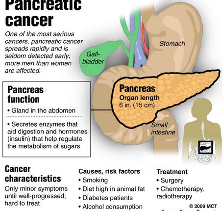 Pancreatic Cancer Causes, Prognosis and Treatment —Health ...