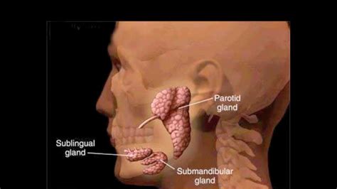 parotitis and salivary gland infections   YouTube
