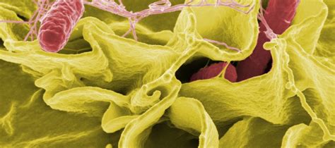 Pathogen or Protector? Salmonella Slams Cancer | Yale ...