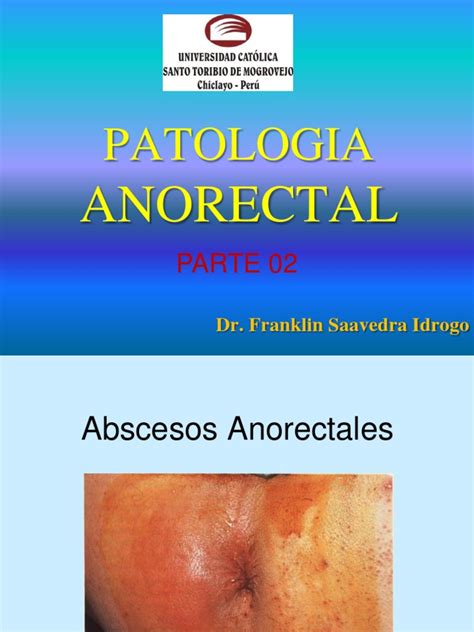 PATOLOGIA_ANORRECTAL_02 | Enfermedad de Crohn | Sexo anal