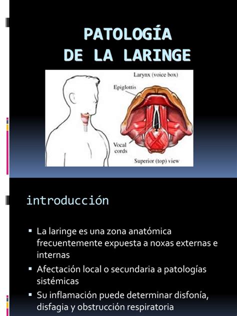 Patología de Laringe | La enfermedad por reflujo ...
