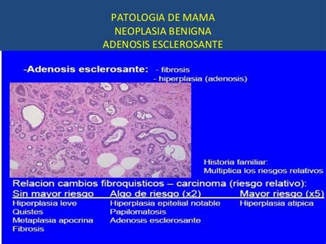 Patologia de mama