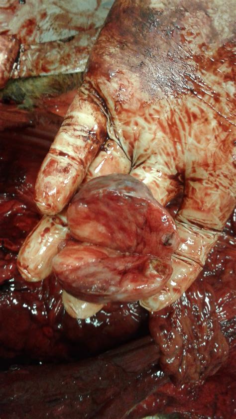 Patologia Veterinária: Teratoma no ovario esquerdo de uma cadela