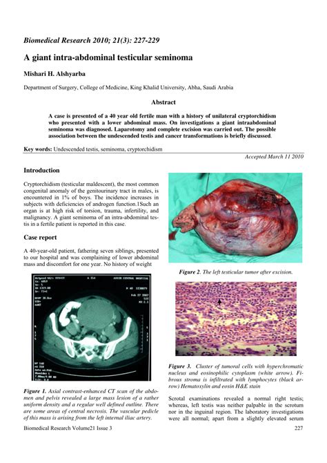 PDF  A giant intra abdominal testicular seminoma