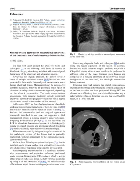 PDF  Minimal invasive technique in mesenchymal hamartoma of the chest ...