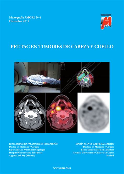 PDF  PET TAC en tumores de cabeza y cuello