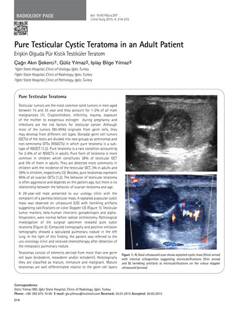PDF  Pure Testicular Cystic Teratoma in an Adult Patient
