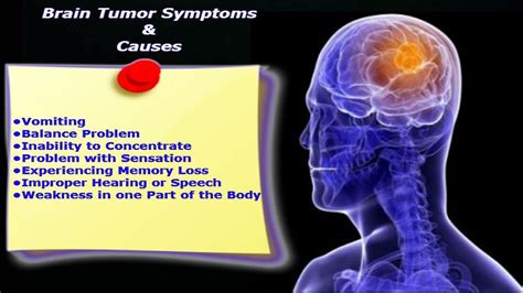 Perceiving Primary Brain Tumor Symptoms in Early Stage