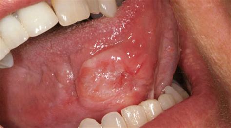 Pictures of Common Dental Problems   American Dental ...