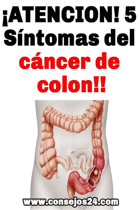 Pin en Síntomas del cáncer de colon