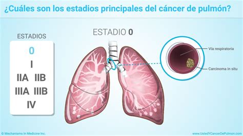 Pin on Usted y el cáncer de pulmón