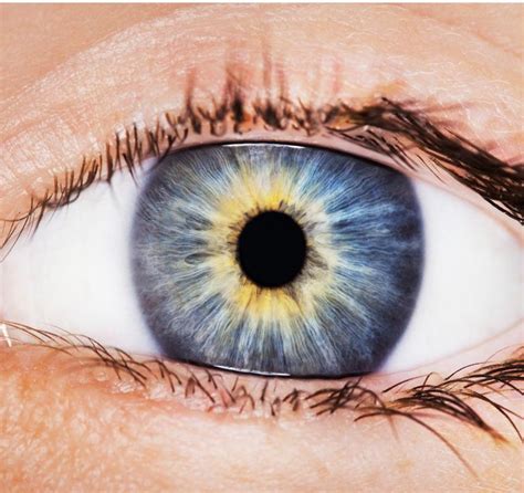 ¿Por qué a veces aparecen manchas rojas en el ojo? | Blog ...