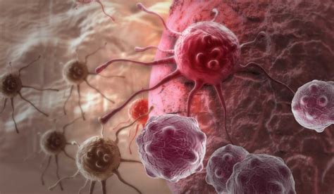 ¿Por qué causas puede padecer cáncer una persona? | Salud