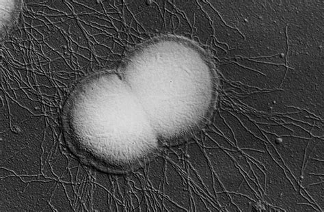 Post: Aumentan casos de gonorrea resistente a los antibióticos
