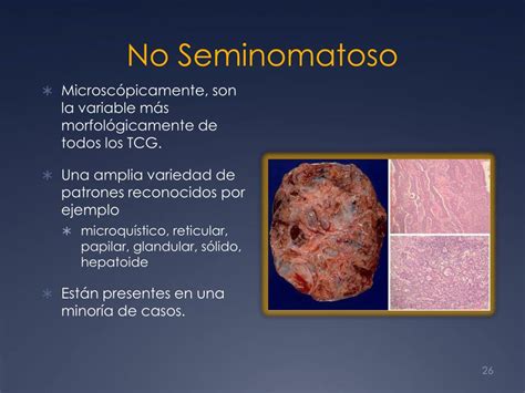 PPT   Cáncer Testicular PowerPoint Presentation, free download   ID:2058410