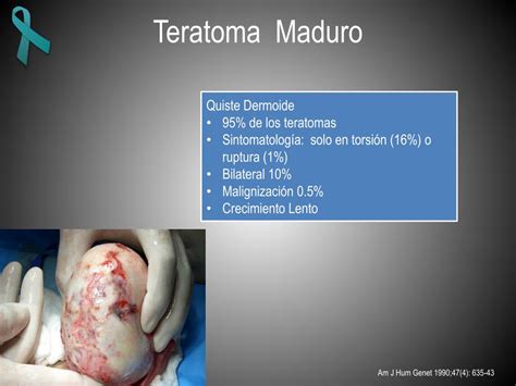 PPT   Generalidades y Tratamiento Quirurgico de Tumores Germinales de ...