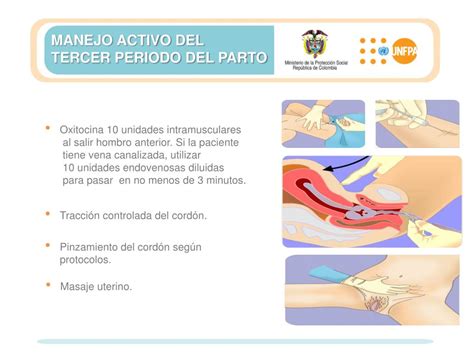 PPT   HEMORRAGIA OBSTÉTRICA PowerPoint Presentation, free download   ID ...