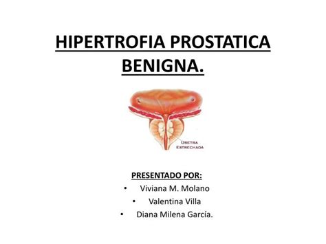 PPT   HIPERTROFIA PROSTATICA BENIGNA. PowerPoint Presentation, free ...