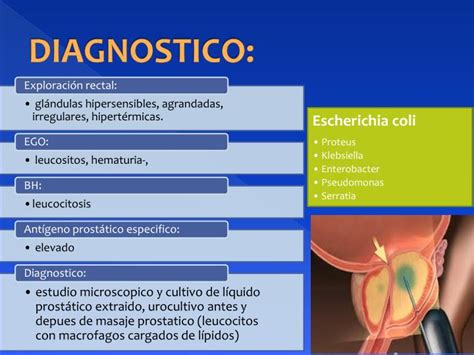 PPT   Infección de la próstata PowerPoint Presentation ...