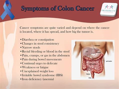 PPT Learn Easily Symptoms, Causes and Treatment of Colon ...