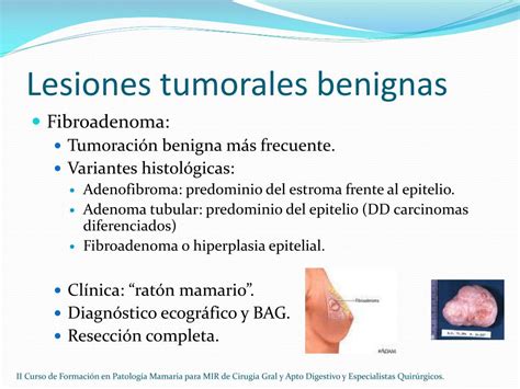 PPT   Patología benigna de la mama PowerPoint Presentation, free ...