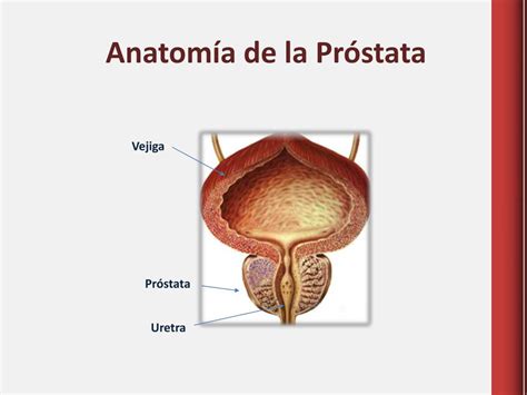 PPT   Sesión Práctica La evidencia en la consulta de HBP PowerPoint ...