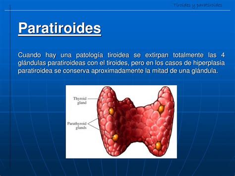 PPT   TIROIDES Y PARATIROIDES PowerPoint Presentation, free download ...