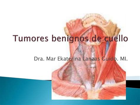 PPT   Tumores benignos de cuello PowerPoint Presentation, free download ...