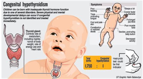 Preventing Congenital Hypothyroidism by Newborn Screening ...