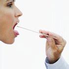 Primeros síntomas del cáncer de lengua | Portal Salud